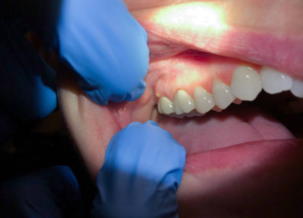 Best Emergency Broken Tooth Repair in Port Vue, PA